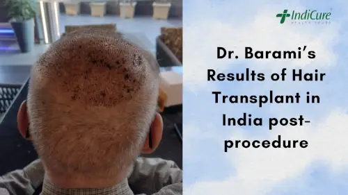 Results of Hair Transplant in India